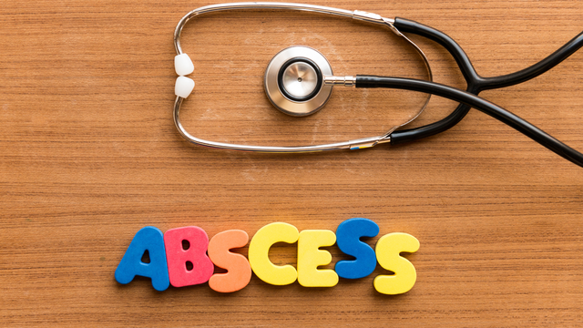 bai-viet/nguoi-bi-ap-xe-co-duoc-tu-nan-mu-ap-xe-hay-khong.html