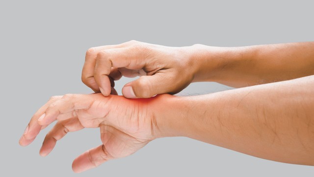 bai-viet/nguoi-bi-zona-co-ngua-khong-cach-giam-trieu-chung-ngua-cua-zona-than-kinh.html