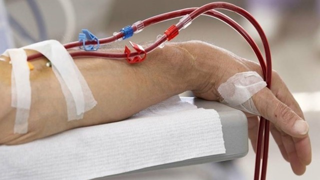 bai-viet/nguoi-binh-thuong-co-nen-loc-mau-khong-nhung-dieu-can-luu-y-khi-loc-mau.html