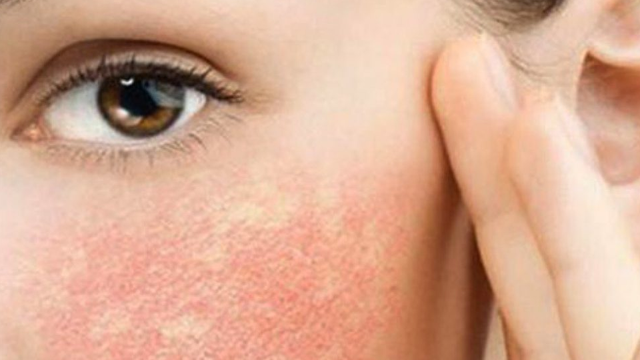 bai-viet/nguoi-co-lan-da-mong-yeu-co-lan-kim-duoc-khong.html