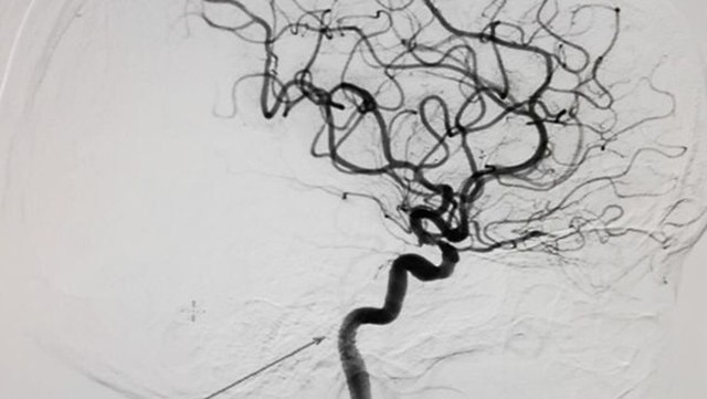 bai-viet/nguyen-ly-chup-mach-so-hoa-xoa-nen-dsa.html