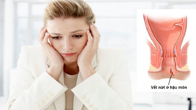 bai-viet/nguyen-nhan-gay-ra-nut-hau-mon-sau-sinh-va-cach-xu-ly-60999.html