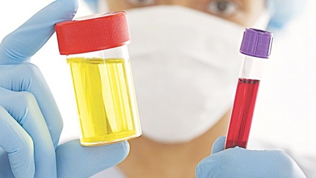 bai-viet/nguyen-nhan-gay-tieu-ra-mau-va-dau-hieu-nhan-biet-benh-ly-61986.html