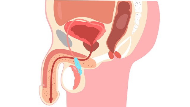 bai-viet/nguyen-nhan-gian-tinh-mach-thung-tinh-la-gi-cach-dieu-tri.html