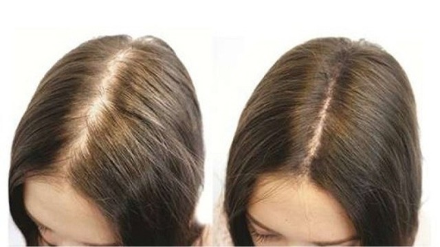 bai-viet/nguyen-nhan-khien-ban-bi-hoi-dau-khi-con-tre.html