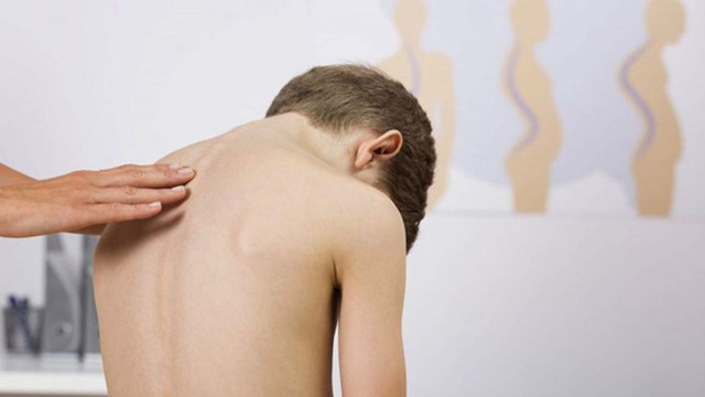 bai-viet/nguyen-nhan-khien-tre-bi-loi-dot-song-lung.html