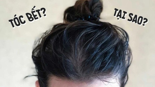 bai-viet/nguyen-nhan-ngu-day-toc-bi-bet.html