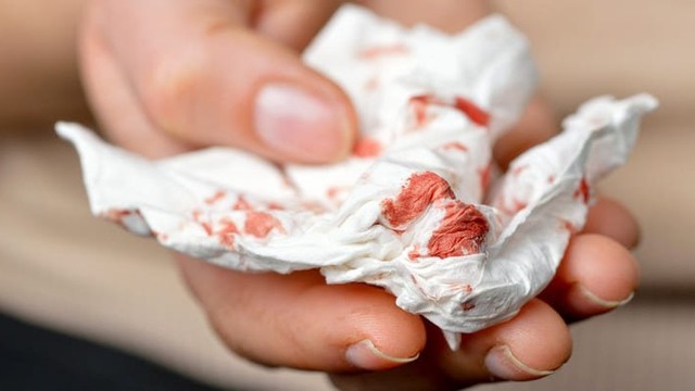 bai-viet/khac-dom-ra-mau-nhung-khong-ho-nguyen-nhan-va-bien-phap-ngan-ngua-la-gi.html