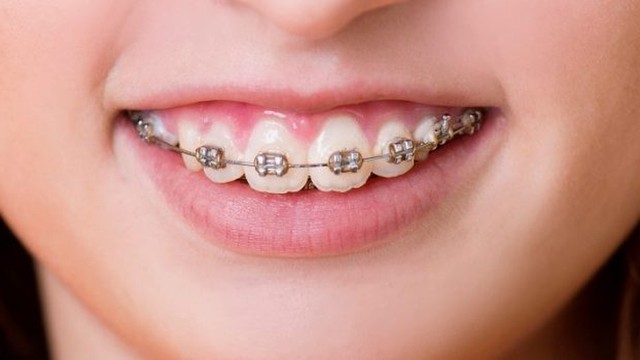 bai-viet/nguyen-nhan-va-cach-khac-phuc-neu-co-dau-hieu-tut-loi-khi-nieng-rang-55121.html