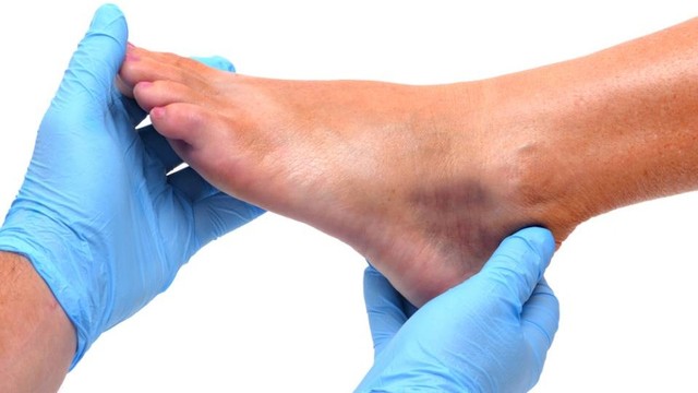 bai-viet/chan-thuong-got-chan-nhan-biet-dau-hieu-chan-doan-som-va-dieu-tri-dung-cach.html