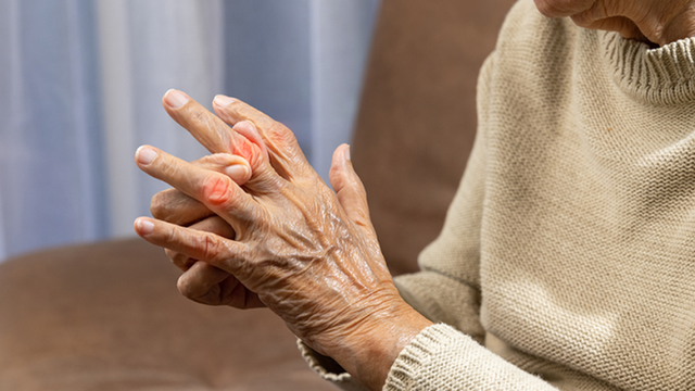 bai-viet/nhan-biet-dau-hieu-som-cua-viem-khop-vay-nen.html