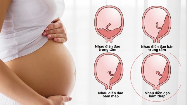 bai-viet/nhau-bam-thap-thuong-toi-tuan-bao-nhieu-thi-het.html