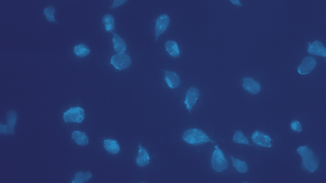 benh/nhiem-balantidium-192.html