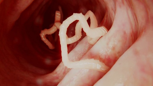 bai-viet/nhiem-san-cho-co-tai-phat-khong-phong-ngua-nhiem-san-cho-tai-phat.html