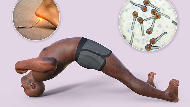 bai-viet/tim-hieu-nhiem-trung-uon-van-co-nguy-hiem-khong.html