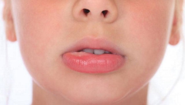 bai-viet/nhiet-mieng-sung-moi-la-gi-nguyen-nhan-va-cach-dieu-tri.html