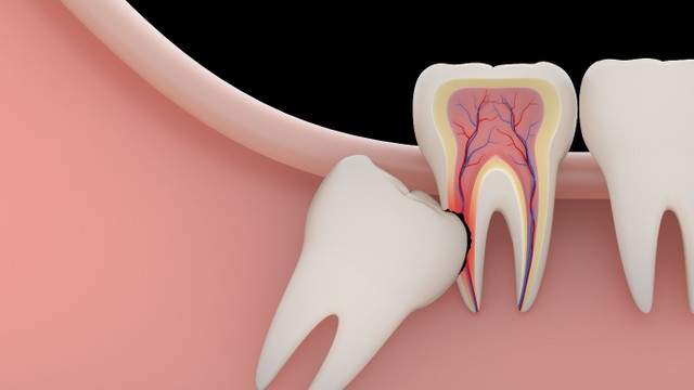 bai-viet/nho-rang-khon-1-ben-co-bi-lech-mat-khong-su-that-ban-can-biet.html