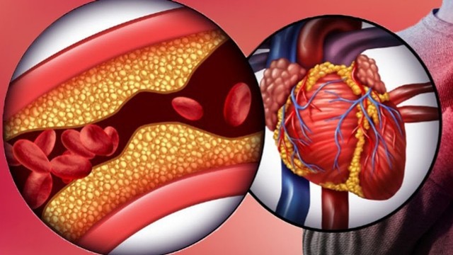 bai-viet/nhung-dieu-ban-chua-biet-ve-nhoi-mau-co-tim-st-chenh-len.html