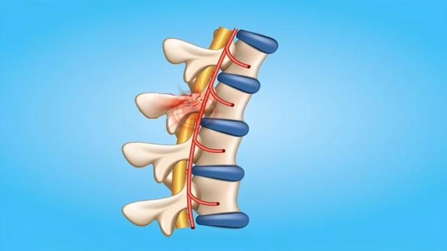 bai-viet/nhoi-mau-tuy-song-trieu-chung-nguyen-nhan-va-cach-dieu-tri.html