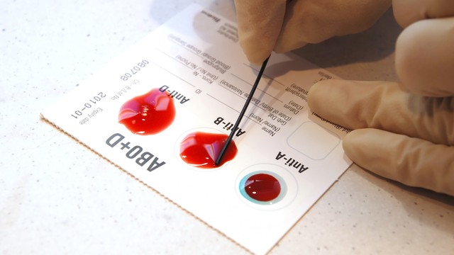 bai-viet/nhom-mau-nao-la-nhom-mau-hiem-nhat-nhung-rui-ro-khi-co-nhom-mau-hiem.html