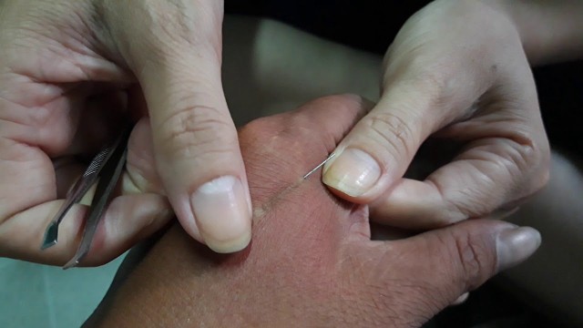 bai-viet/nhung-cach-lay-dam-trong-tay-khong-phai-ai-cung-biet-64847.html