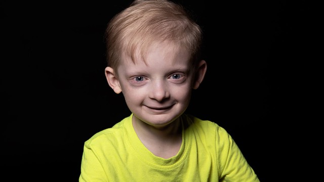 bai-viet/nhung-dieu-can-biet-ve-loan-san-ngoai-bi-va-phuong-phap-dieu-tri.html