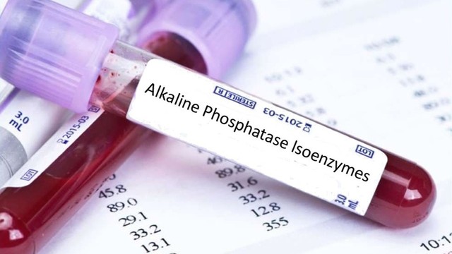 bai-viet/nhung-dieu-can-biet-ve-xet-nghiem-phosphatase-kiem.html