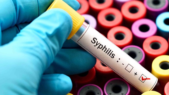bai-viet/nhung-dieu-can-biet-ve-xet-nghiem-syphilis-ab-va-benh-giang-mai.html