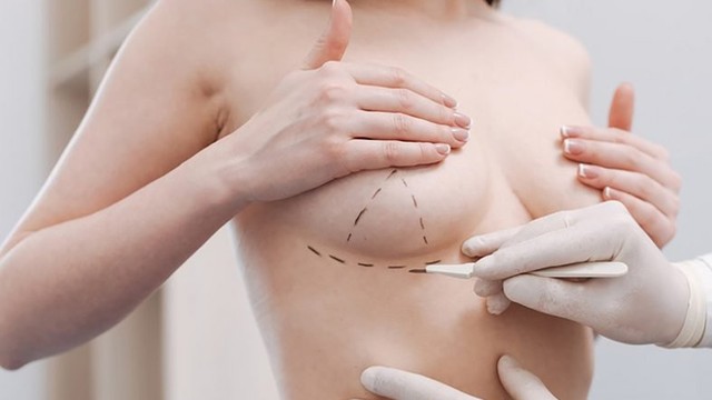 bai-viet/nhung-dieu-can-luu-y-khi-phau-thuat-thu-nho-nguc-66512.html