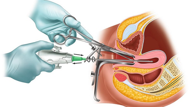 bai-viet/nhung-hau-qua-dang-so-khi-lam-dung-hut-dieu-hoa-kinh-nguyet.html