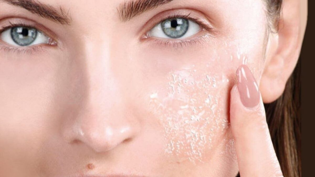 bai-viet/nhung-luu-y-truoc-khi-peel-da-va-cham-soc-da-sau-peel-ban-can-biet.html