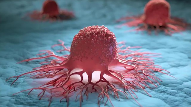 bai-viet/nhung-tac-dung-phu-muon-va-so-lieu-thong-ke-benh-nhi-mac-khoi-u-wilms-o-tre-em-72846.html