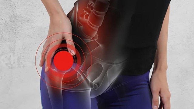 bai-viet/nhung-thong-tin-ve-chung-viem-khop-hang-ben-trai-52149.html