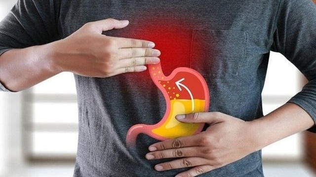 bai-viet/cac-loai-thuoc-dac-tri-trao-nguoc-da-day-cua-my-thuong-duoc-su-dung-hien-nay.html