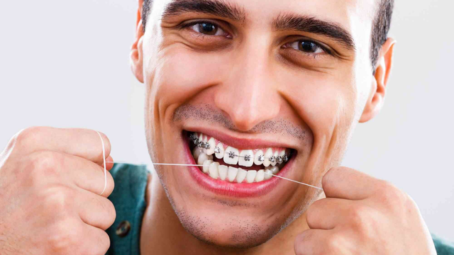 bai-viet/nieng-rang-o-nguoi-lon-co-loi-ich-gi-thoi-gian-dieu-tri-chinh-nha-cho-nguoi-lon-la-bao-lau.html