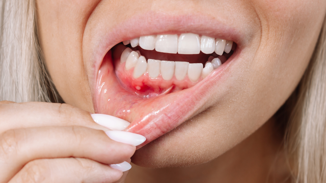 bai-viet/noi-cuc-cung-o-loi-do-dau-10-nguyen-nhan-gay-ra-va-phuong-phap-dieu-tri.html