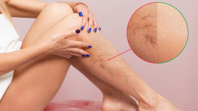 bai-viet/noi-gan-tim-o-chan-nguyen-nhan-va-cach-khac-phuc.html