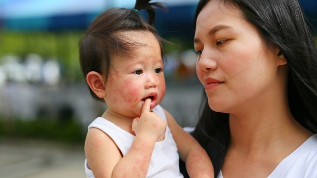 bai-viet/noi-me-day-di-ung-o-tre-co-nguy-hiem-khong-54787.html