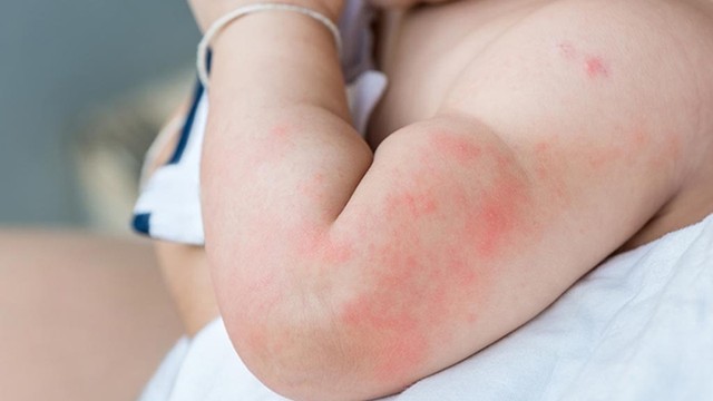 bai-viet/noi-me-day-o-tre-em-co-nguy-hiem-khong-54425.html