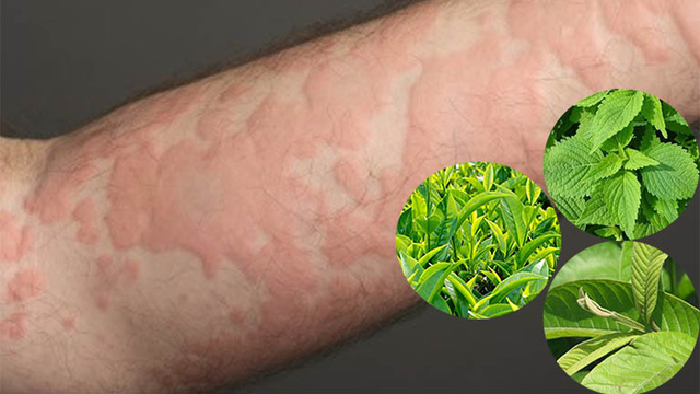 bai-viet/noi-me-day-tam-la-gi-nhanh-khoi-55284.html