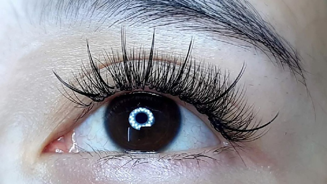 bai-viet/noi-mi-mat-uot-la-gi-noi-mi-nhieu-co-hai-hay-khong.html