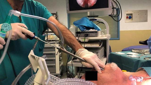 bai-viet/noi-soi-phe-quan-ong-cung-chi-dinh-chong-chi-dinh-va-quy-trinh-cu-the.html