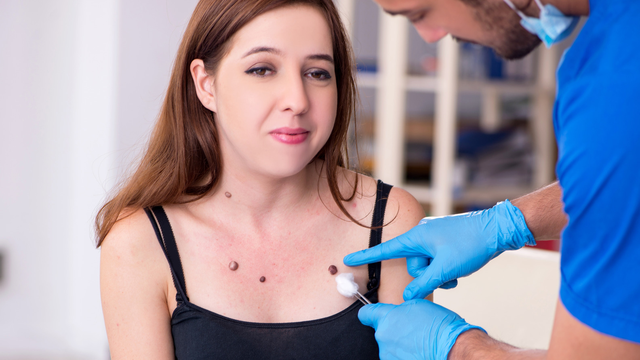 bai-viet/not-ruoi-o-nguc-co-phai-ung-thu-vu-khong.html