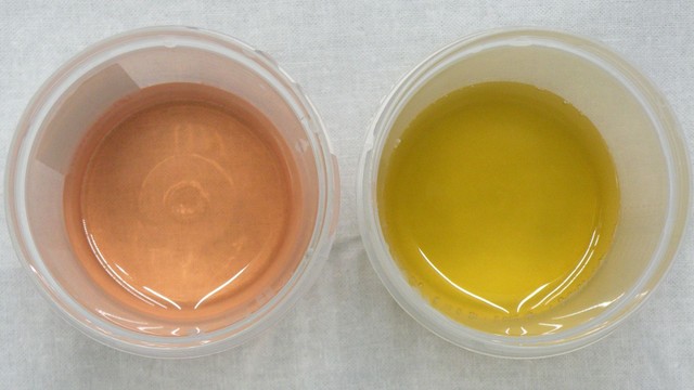 bai-viet/nuoc-tieu-mau-hong-nguyen-nhan-va-cach-phong-ngua-hieu-qua.html