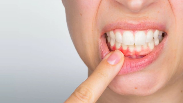 bai-viet/nguyen-nhan-nuou-rang-bi-do-va-cach-xu-tri.html