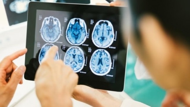 bai-viet/phac-do-dieu-tri-ap-xe-nao-hieu-qua-nhat-59431.html