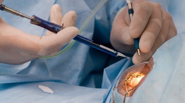 bai-viet/phacoemulsification-la-gi-tim-hieu-ve-phuong-phap-phau-thuat-phaco.html