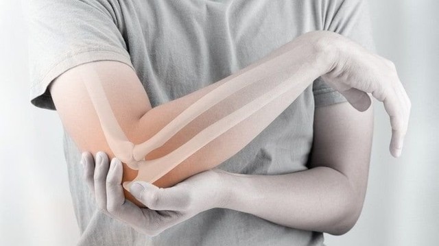 bai-viet/phai-lam-gi-khi-bi-trat-khop-khuyu-tay-58142.html