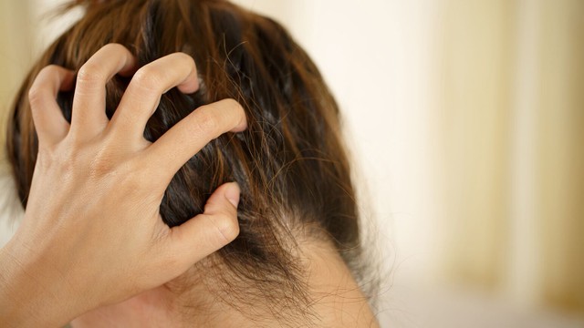 bai-viet/phan-biet-dau-hieu-cua-bi-gau-va-benh-vay-nen-da-dau.html