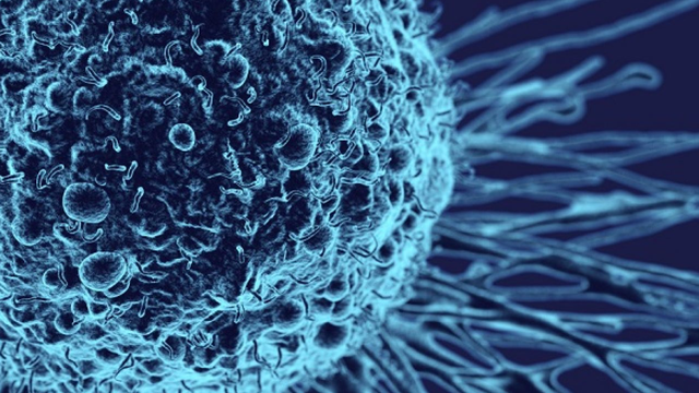 bai-viet/phan-do-mo-hoc-cua-khoi-u-la-gi-54225.html